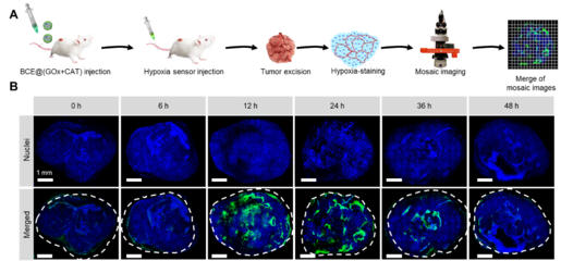 中國(guó)科學(xué)技術(shù)大學(xué)王育才教授:納米級(jí)聯(lián)簇化酶用于腫瘤葡萄糖耗竭治療